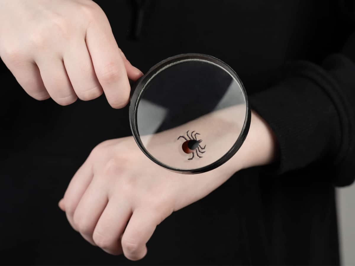 Person Looking at Tick on Hand in Magnifying Glass.