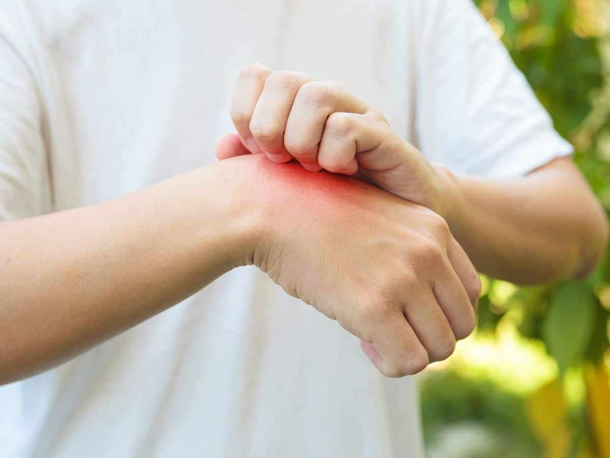 A man scratching his wrist after a painful tick bite.