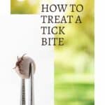 How to treat a tick bite.
