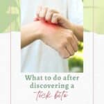 What to do after discovering a tick bite.